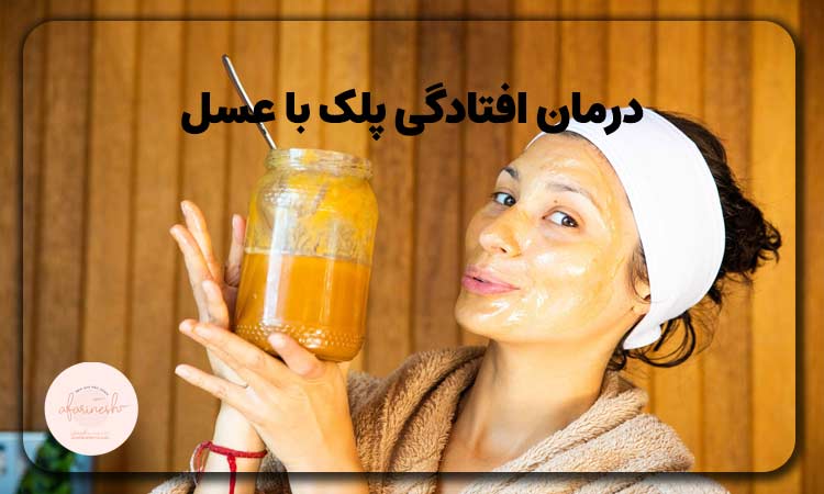 درمان افتادگی پلک با عسل