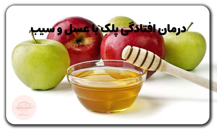 درمان افتادگی پلک با عسل و سیب