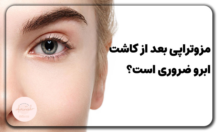 ایا مزوتراپی بعد از کاشت ابرو واجب است