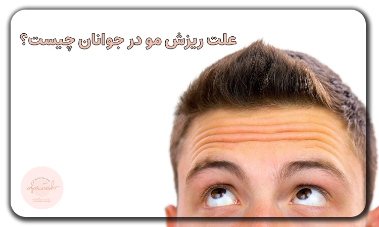 علت ریزش مو در 17 سالگی پسران