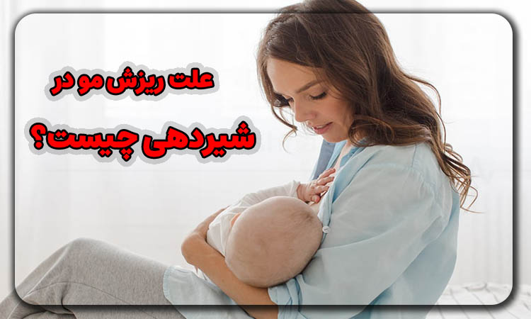 علت ریزش مو در شیردهی