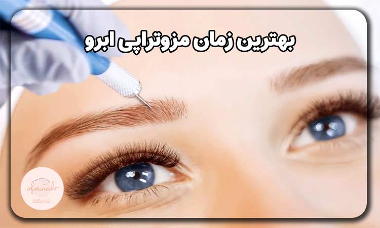 بهترین زمان مزوتراپی بعد از کاشت ابرو
