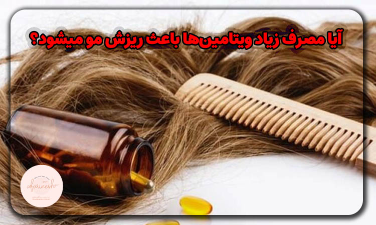 مصرف زیاد ویتامین‌ها باعث ریزش مو میشود؟