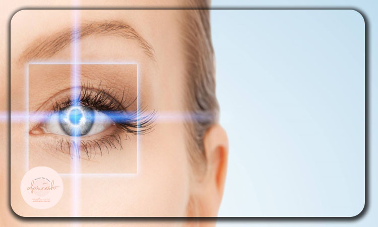 اختلال جداشدگی پرده شبکیه