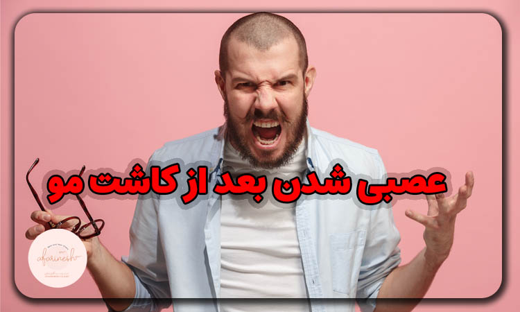 عصبی شدن بعد از کاشت مو