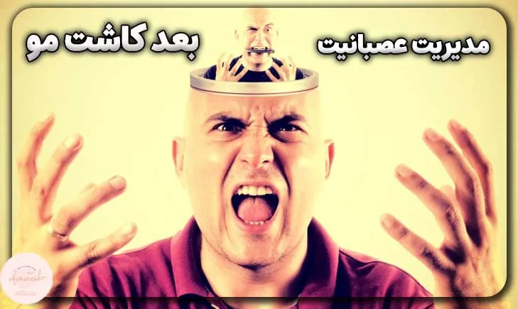 مدیریت عصبی شدن بعد از کاشت مو