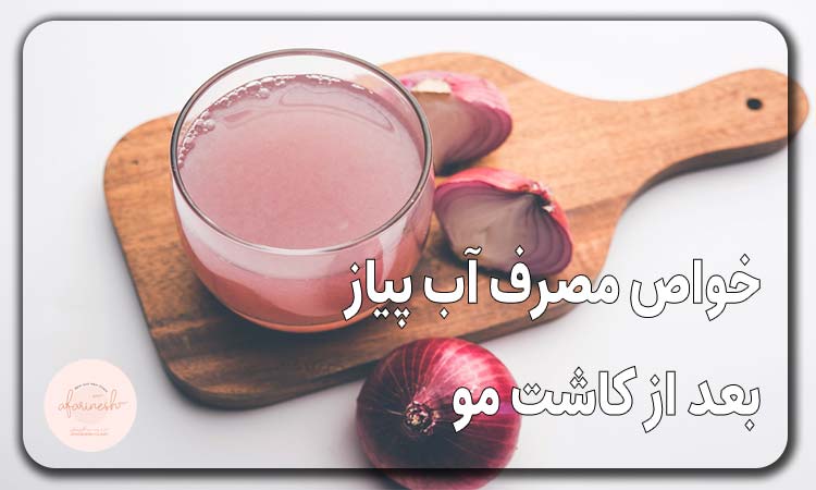 خواص مصرف آب پیاز بعد از کاشت مو