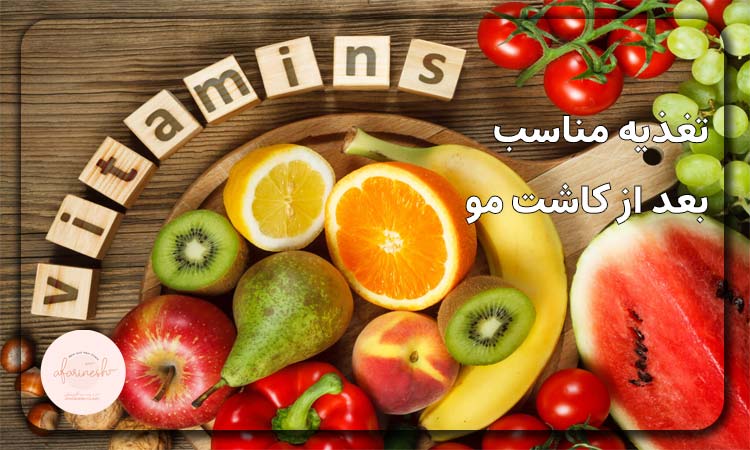 تغذیه مناسب بعد از کاشت مو