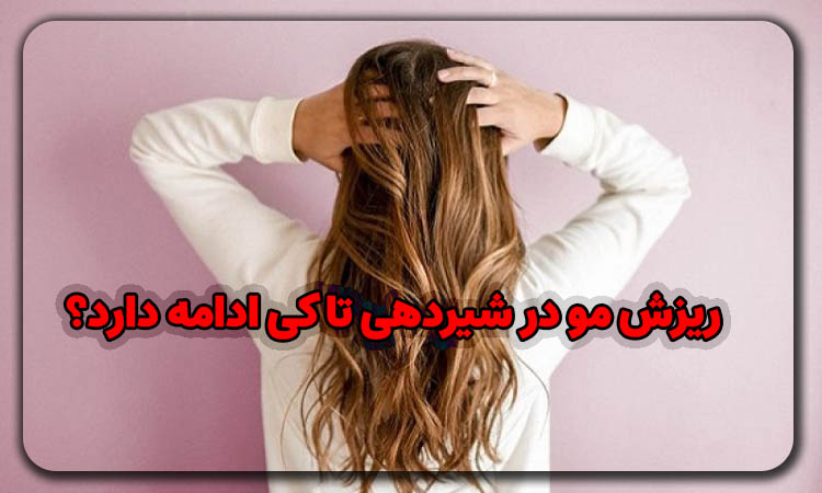 ریزش مو در شیردهی