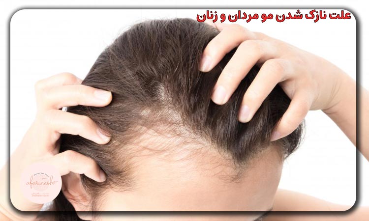 علت نازک شدن مو