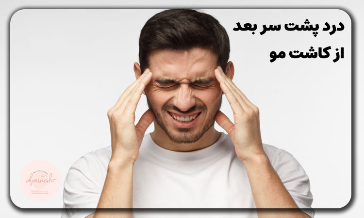 درد پشت سر بعد از کاشت مو