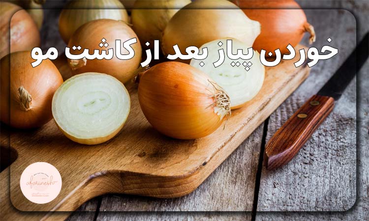 خوردن پیاز بعد از کاشت مو