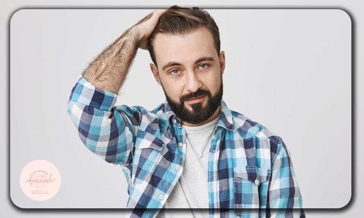 کاشت مو به روش DHI