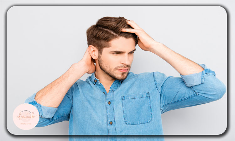 نمونه کاشت مو به روش DHI