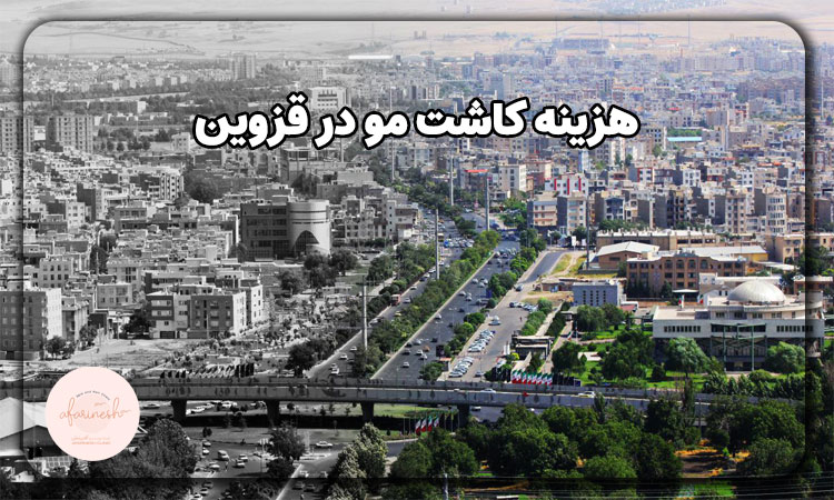هزینه کاشت مو در قزوین