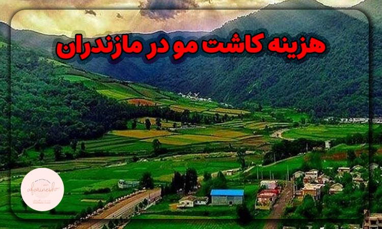 هزینه کاشت مو در مازندران