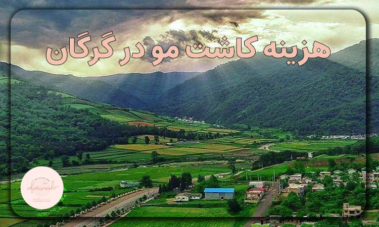هزینه کاشت مو در گرگان