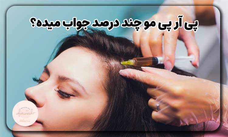 پی آر پی مو چند درصد جواب میده؟