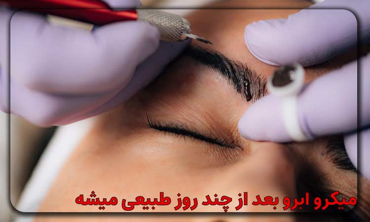 میکرو ابرو بعد از چند روز طبیعی میشه