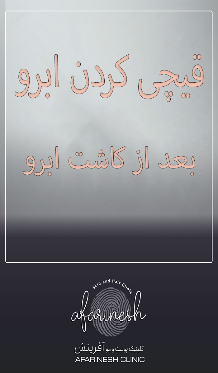 فیلم برس، اصلاح و قیچی کردن ابرو بعد از کاشت