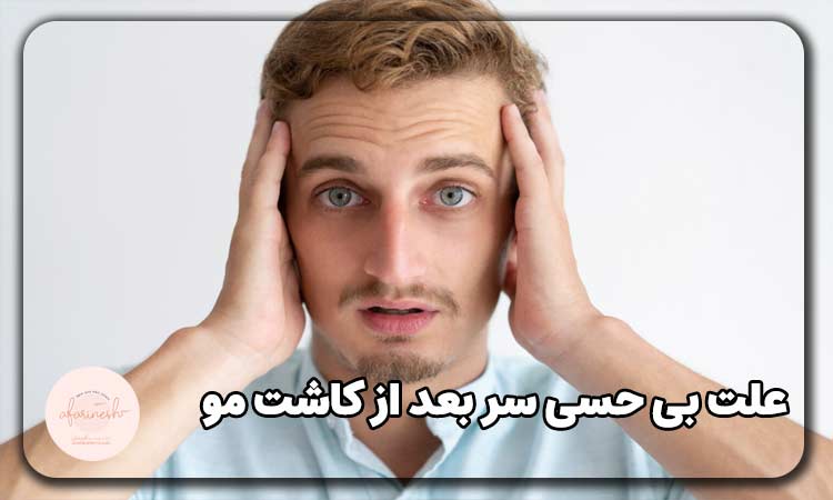 علت بی حسی سر بعد از کاشت مو