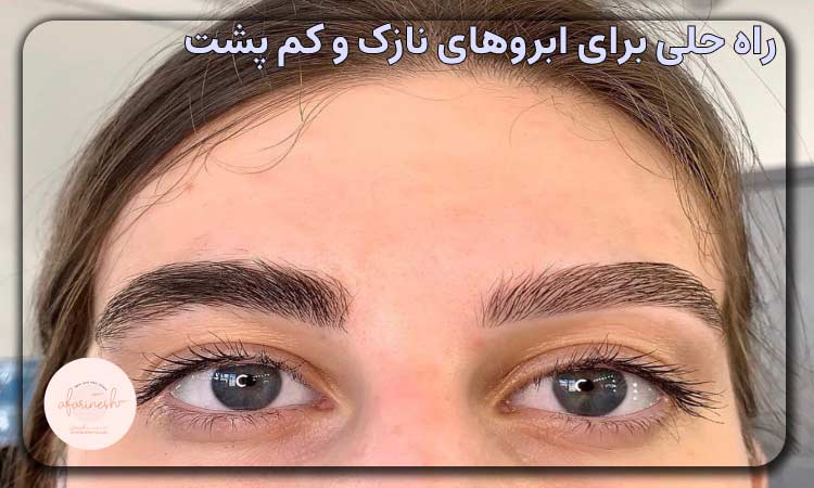 ابرو کم پشت