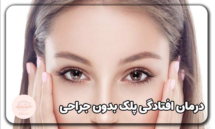 روش های درمان افتادگی پلک بدون جراحی