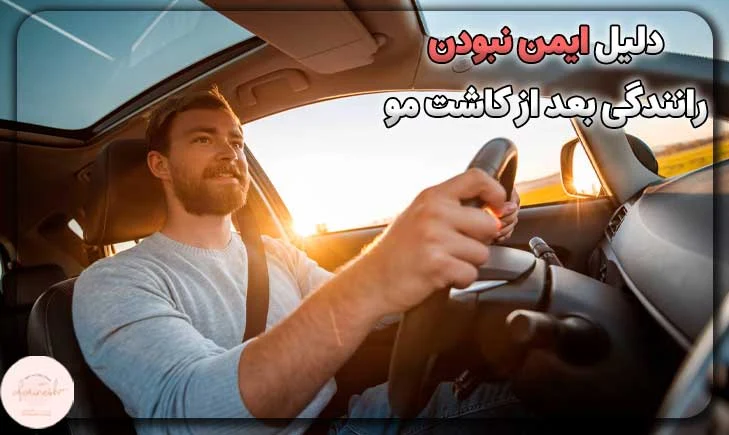دلیل ایمن نبودن رانندگی بعد از کاشت مو