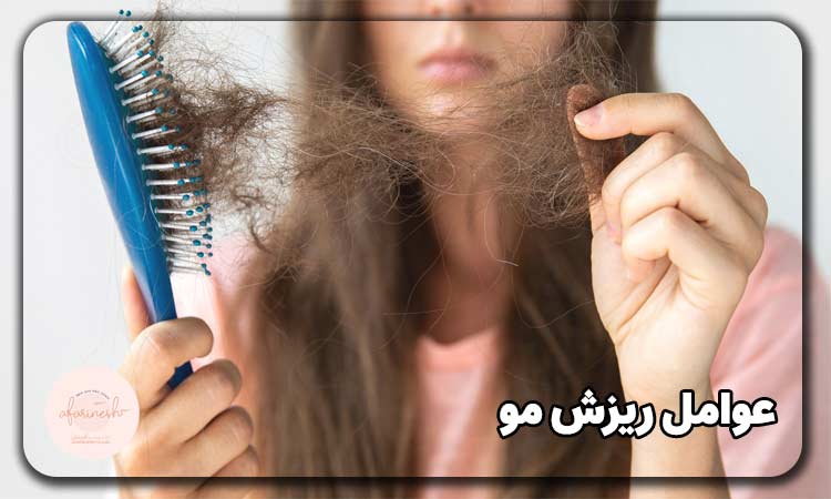 عوامل ریزش مو