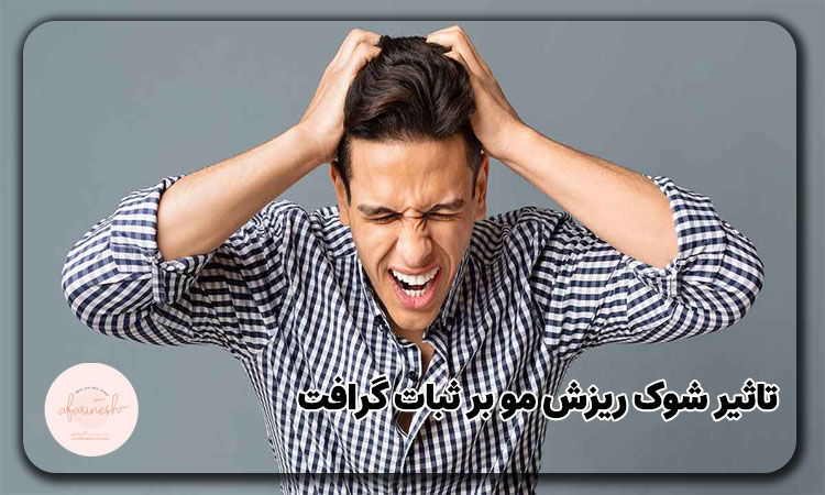 تاثیر شوک ریزش مو بر ثبات گرافت