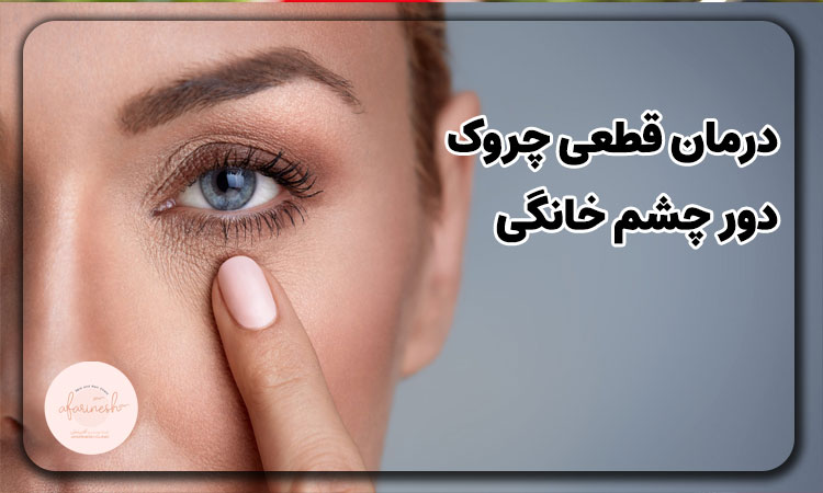 درمان قطعی چروک دور چشم خانگی