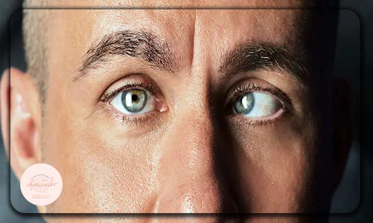 علائم و تشخیص دوبینی چشم چگونه است؟