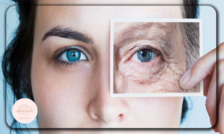 روشهای پیشگیری از چروکی دور چشم