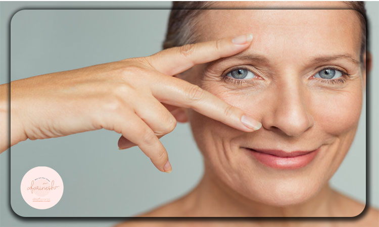 دلایل چروکی دور چشم چیست؟