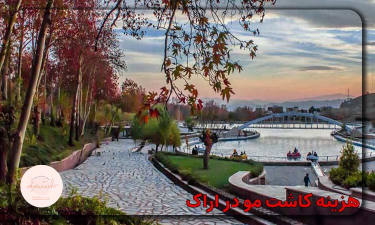 هزینه کاشت مو در اراک