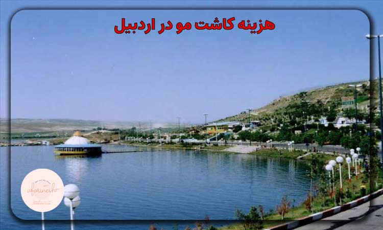 هزینه کاشت مو در اردبیل