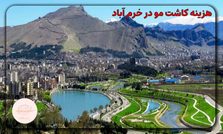هزینه کاشت مو در خرم آباد