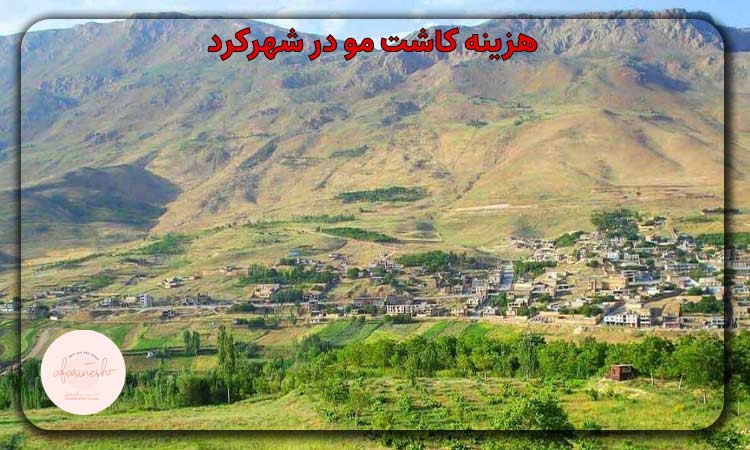 هزینه کاشت مو در شهرکرد