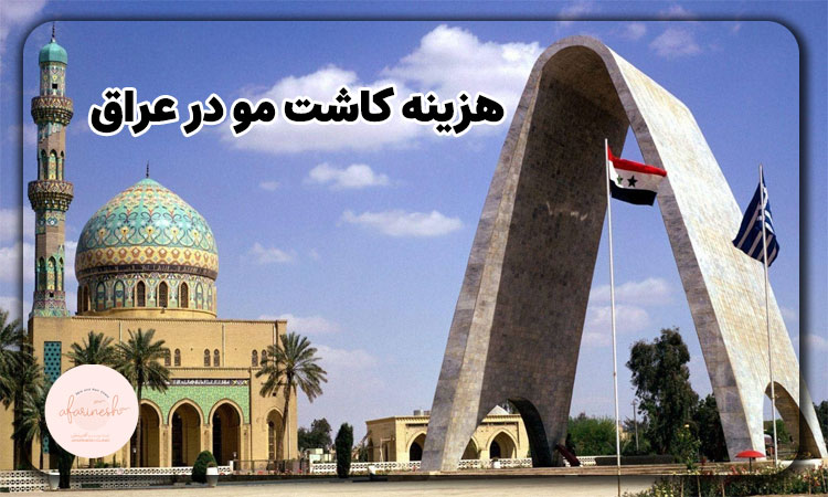 هزینه کاشت مو در عراق