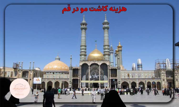 هزینه کاشت مو در قم