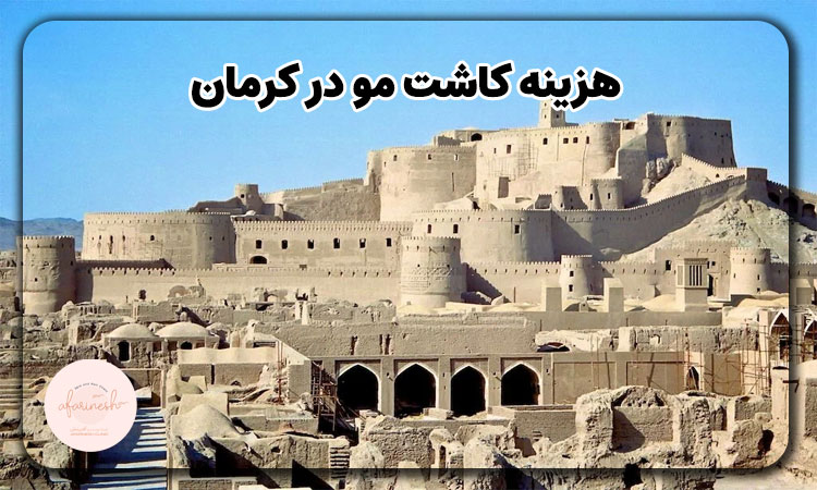 هزینه کاشت مو در کرمان