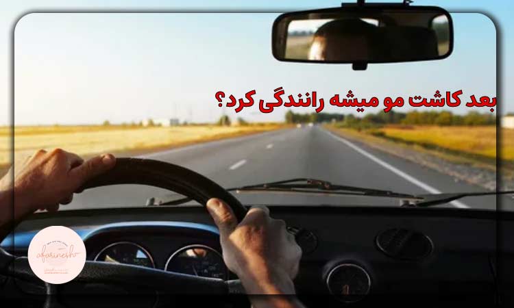 رانندگی بعد از کاشت مو
