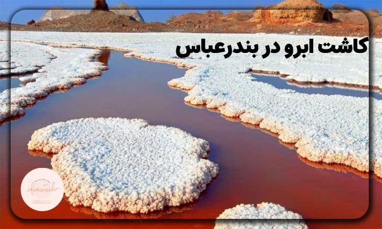 کاشت ابرو در بندرعباس