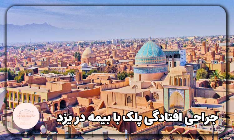 جراحی افتادگی پلک با بیمه در یزد