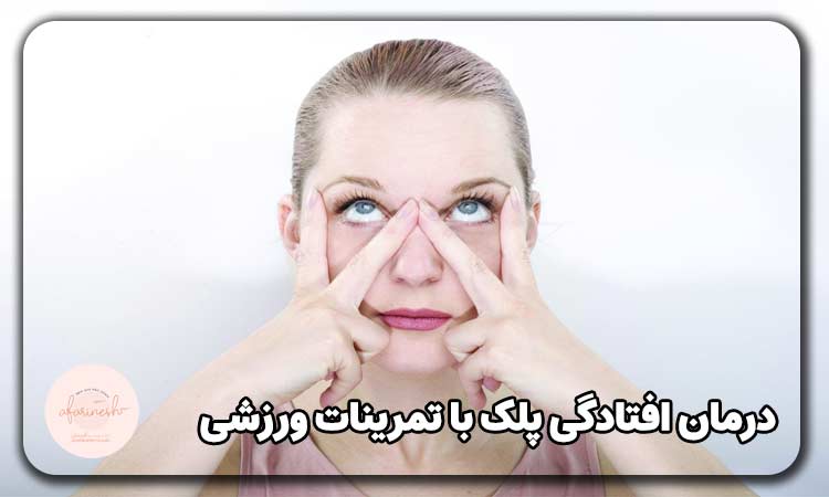 درمان افتادگی پلک با تمرینات ورزشی