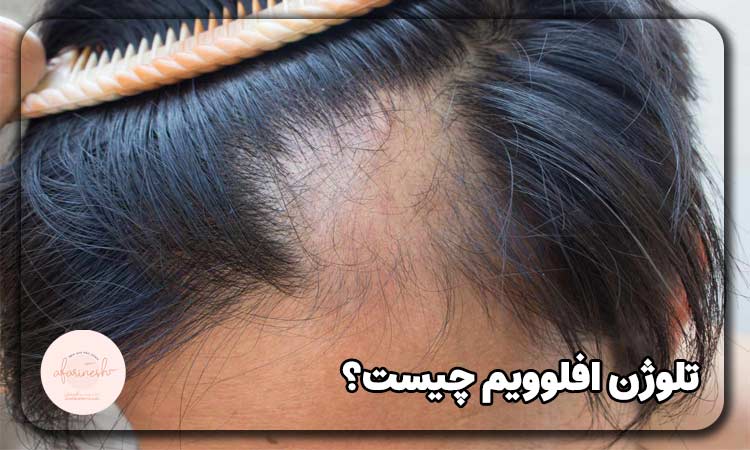تلوژن افلوویوم