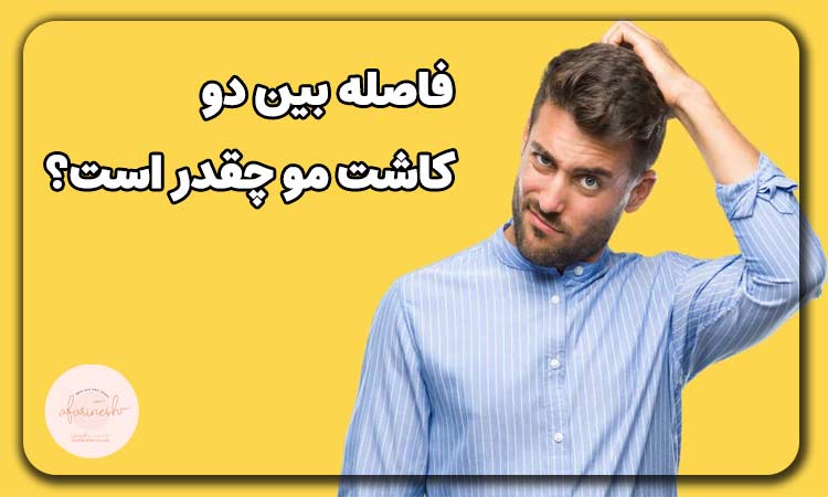 فاصله بین دو کاشت مو