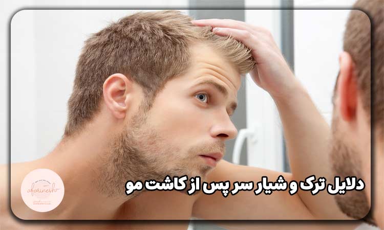 دلایل ترک و شیار سر پس از کاشت مو