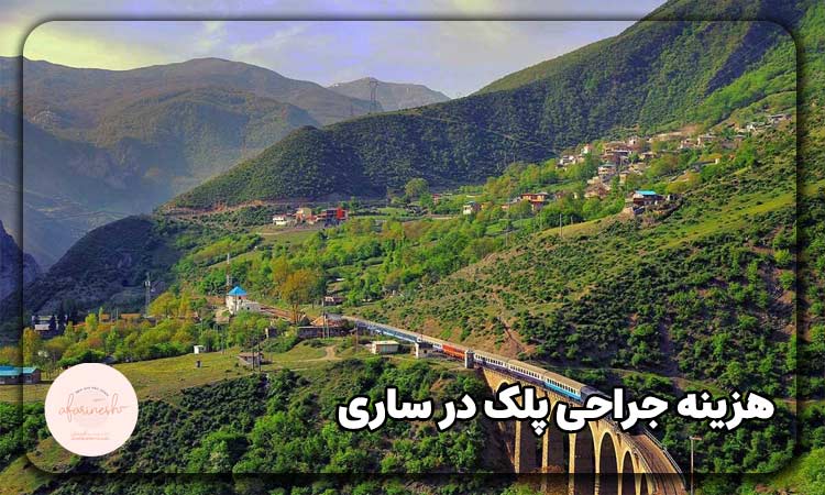هزینه جراحی پلک در ساری