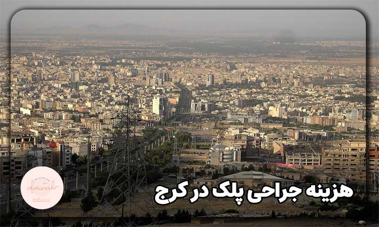 هزینه جراحی پلک در کرج